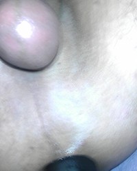 photo-thumb