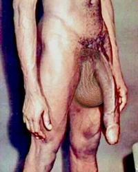 photo-thumb