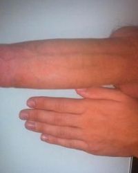 photo-thumb