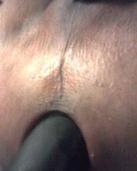 photo-thumb