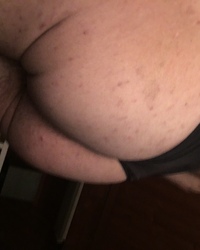 photo-thumb