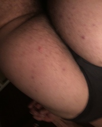 photo-thumb
