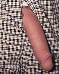 photo-thumb