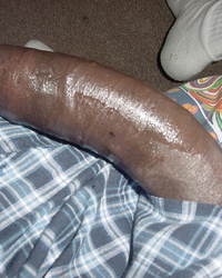 photo-thumb