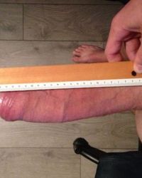 photo-thumb