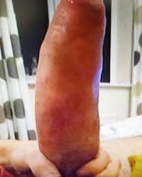 photo-thumb