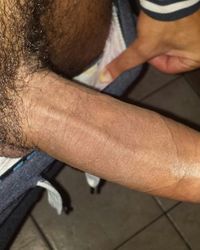 photo-thumb