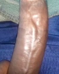 photo-thumb