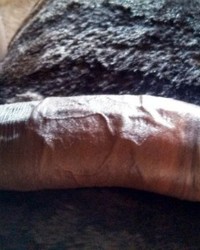 photo-thumb