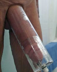 photo-thumb