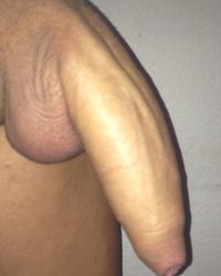 photo-thumb