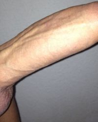 photo-thumb