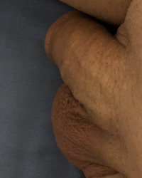 album-cover