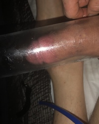 photo-thumb