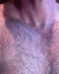 album-cover