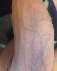 photo-thumb