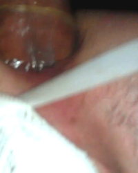 photo-thumb