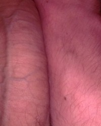photo-thumb