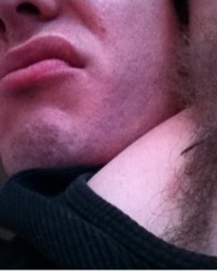 photo-thumb