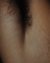 photo-thumb
