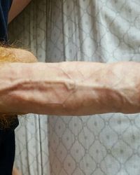 photo-thumb