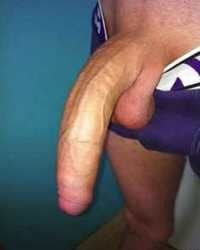 photo-thumb