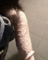 photo-thumb