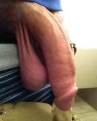 photo-thumb