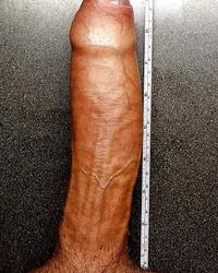photo-thumb