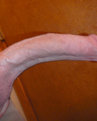 photo-thumb