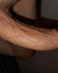 photo-thumb