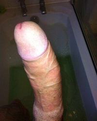photo-thumb