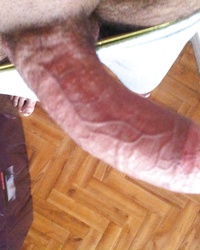 photo-thumb