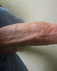 photo-thumb