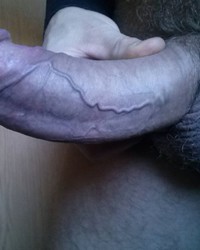 photo-thumb
