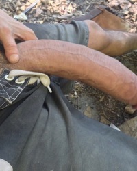 photo-thumb