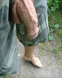 photo-thumb