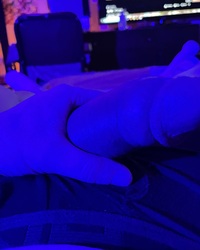 photo-thumb
