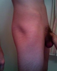 photo-thumb