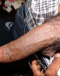 photo-thumb