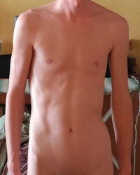 photo-thumb