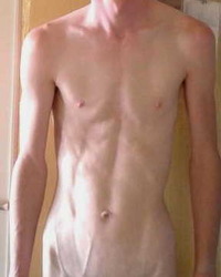 photo-thumb