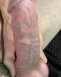 photo-thumb