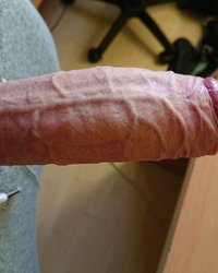 photo-thumb
