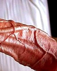 photo-thumb