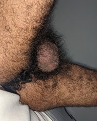 photo-thumb