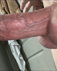photo-thumb