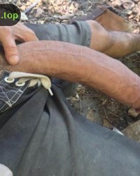 photo-thumb