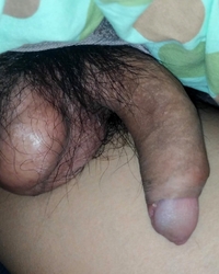 photo-thumb
