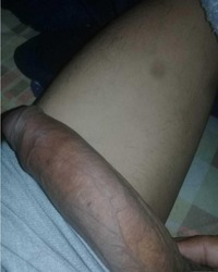 photo-thumb